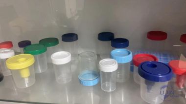 urine container mould